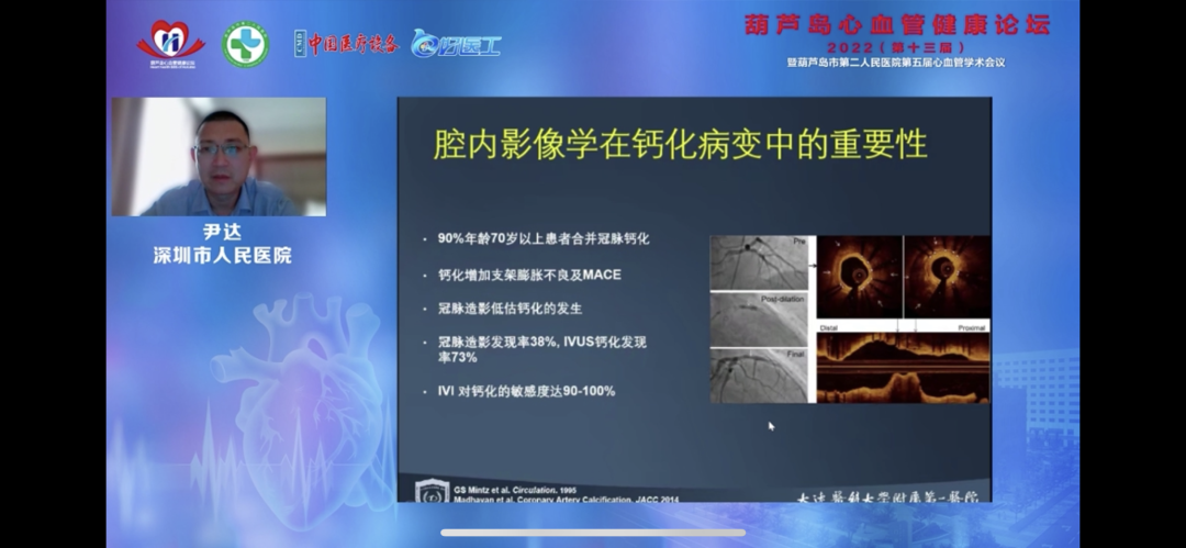 葫蘆島心血管健康論壇?2022｜創(chuàng)新驅(qū)動(dòng)發(fā)展，不斷提升心血管疾病救治能力(圖11)